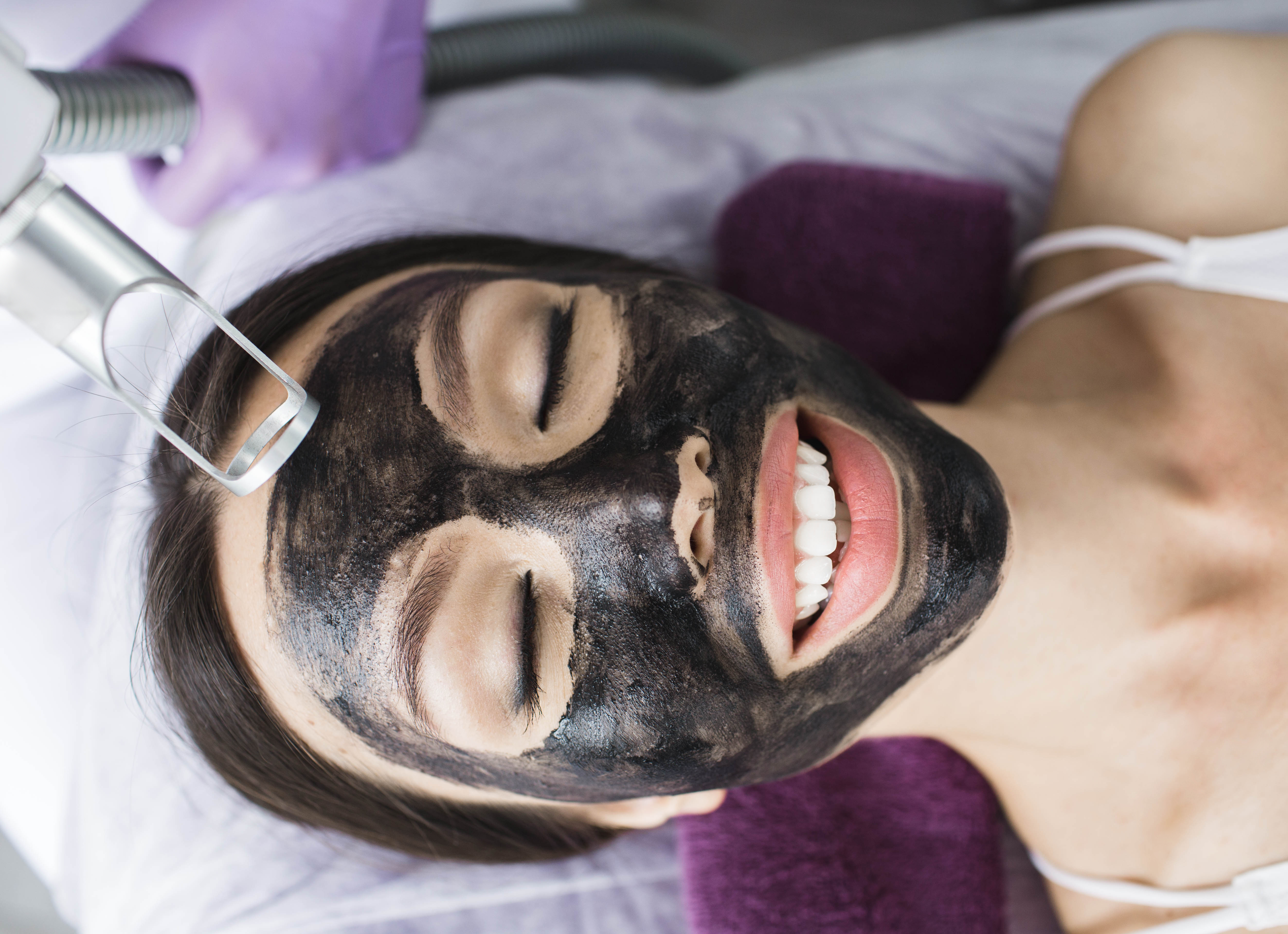 Carbon Laser Facial
